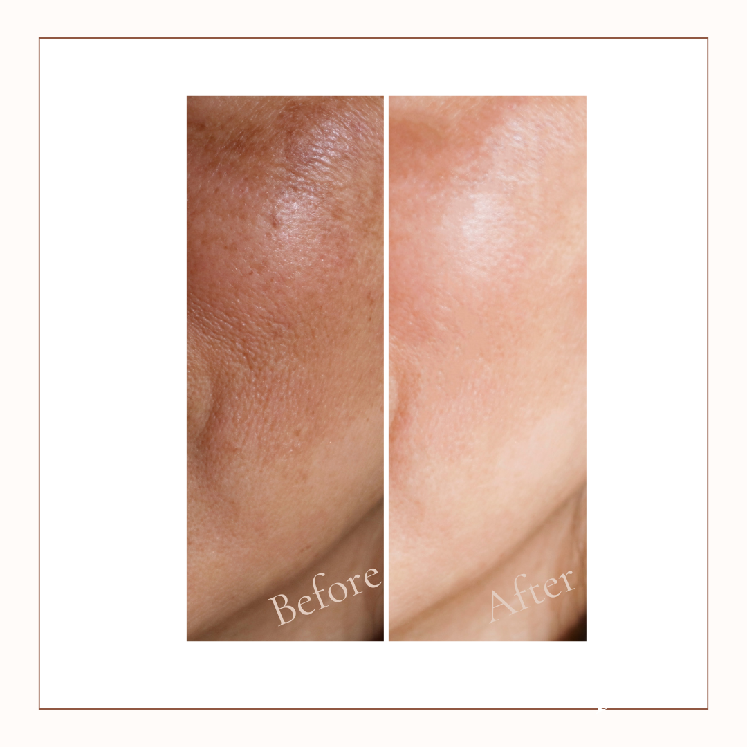 C+ Ferulic Serum • Menopausal Skin & Dark Spot Concerns