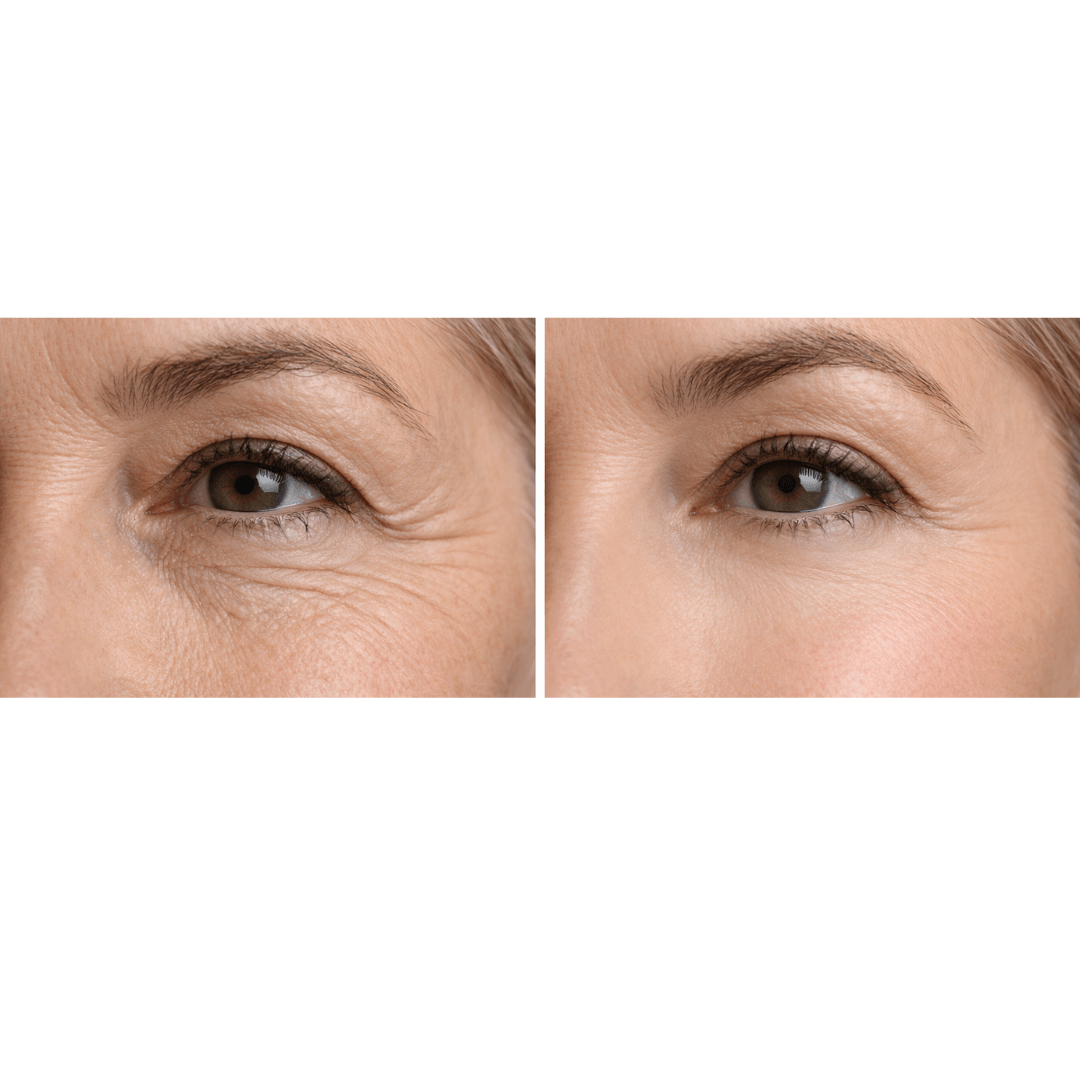 Eye — Lightweight Day Eye Cream · Designed for Daily Refinement - Qualerex Beauty