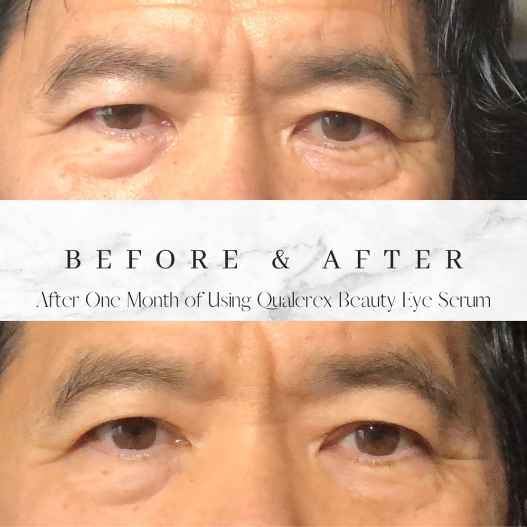 Qualerex Beauty Eye Serum with Green Caviar • Deep Nourishment. Radiant Eyes. Timeless Beauty - Qualerex Beauty
