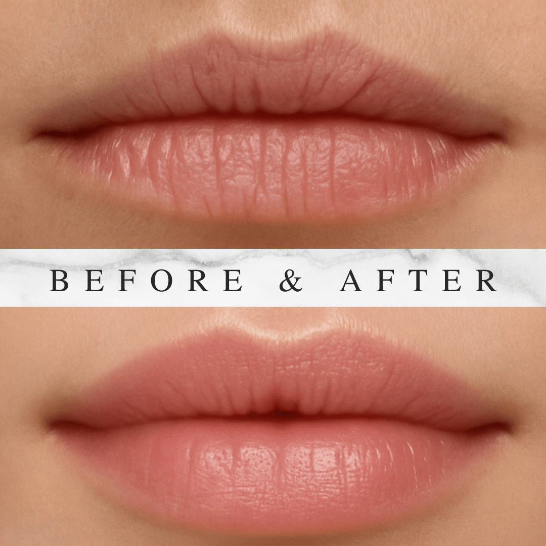 Renew Lip Balm Sphere • Restore Softness. Reveal Radiance - Qualerex Beauty